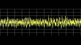 Influenza also Colds  Rife Frequencies [upl. by Gun]