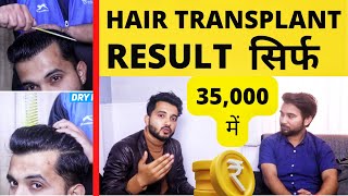 Life After Full Hair Transplant Result Of Saurabh Kukreti  Best Hairline Ever Created In History [upl. by Eugene]