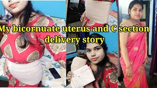 my bicornuate uterus and C section delivery story [upl. by Pelage]