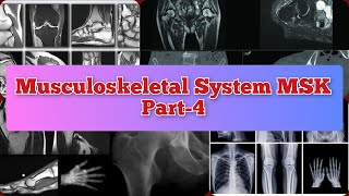 Radiology Viva Cases  399403  Musculoskeletal System Part4  MSK medical radiology ultrasound [upl. by Matias806]