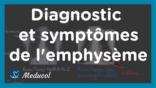 Emphysème symptôme distension thoracique Tiffeneau et dosage de alpha 1 antitrypsine [upl. by Eyahs]