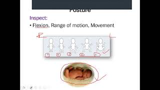 NEONATAL EXAMINATION [upl. by Kcirderfla]