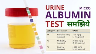 Micro Albumin Urine Test Procedure Results Analysis and Normal Range in Hindi [upl. by Eiuqcaj714]