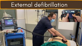 External defibrillation DC Shock [upl. by Fachanan571]