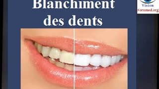 Blanchiment des dents techniques [upl. by Hubing]