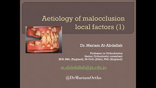 Dr Mariam Aetiology of Malocclusion Local factors 1 [upl. by Levon]