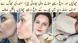 Remove Freckles Dark Spots Pigmentation In Just 7 Days  Samundari Jhag se Dagh Dhaby Chahiyan Saaf [upl. by Ahseinat]