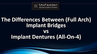 Implant Bridges vs Implant Dentures AllOn4 [upl. by Anileh548]