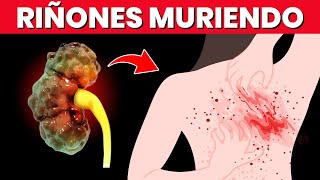 ¡SEÑALES DE QUE TUS RIÑONES ESTÁN MURIENDO [upl. by Madancy]