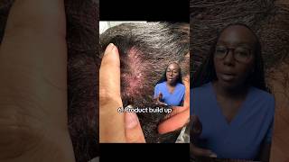 10 Causes of ITCHY Scalp [upl. by Shamus]