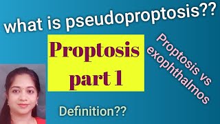 Proptosis Exophthalmos Pseudoproptosis Causes for psuedoproptosis MBBS Ophthalmology [upl. by Atteiluj242]