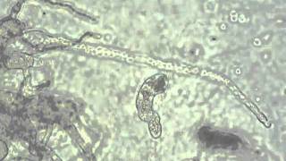 Catenaria anguillulae zoospore discharge [upl. by Neehahs753]