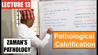 General Pathology Lecture 13  Pathological Calcification [upl. by Kovacev]