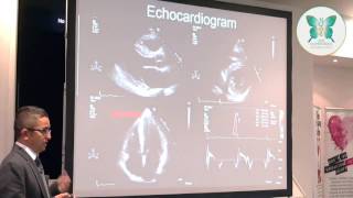 Advanced diagnostics in inherited cardiac conditions SADSconf2017 [upl. by Aisauqal]