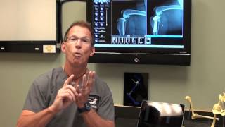 Canine ACL Tears and TPLO Surgery discussed by Dr Bauer DVM DACVS [upl. by Sanjiv]