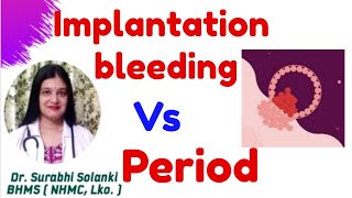 Implantation bleeding vs period  Implantation symptoms  Hindi [upl. by Gertrudis724]