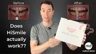 HiSmile Review By A Dentist Dr Grant McGrath [upl. by Neffets]