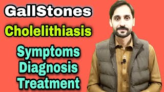 Gallstone  Cholelithiasis [upl. by Arze]