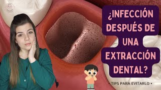 COMO SABER SI SE ME INFECTÓ UNA EXTRACCIÓN DE MUELA 😱🦷  tips para PREVENIRLO en 2023 ✅ [upl. by Spanos]