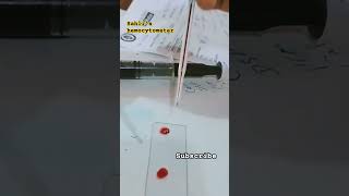 Sahlis hemocytometer shortfeed trending health science viral youtubeshorts collection viral [upl. by Kreda]