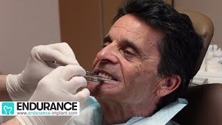 Prothèse amovible  Travail du dentiste et prothésiste  Dr SUBA Hongrie [upl. by Medovich]