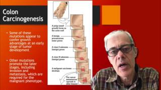 14 Colon cancer pathogenesis  gene mutations [upl. by Assek25]