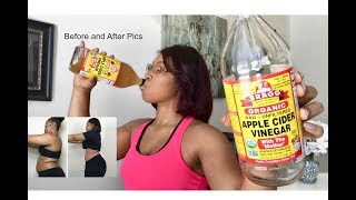 Drinking Apple Cider Vinegar  Lose weight FAST [upl. by Arob]