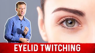 Eyelid Twitching Find Out Causes and Cure – Dr Berg [upl. by Ahseinar766]