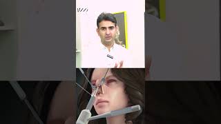 ultrasonic Rhinoplasty Pakistan rhinoplasty nosejobbeforeafter crooked draminyousaf [upl. by Paddie]