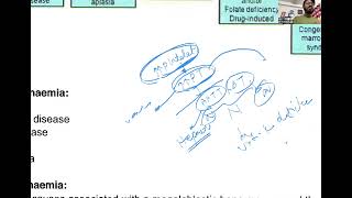 study with tahsin about hematological disease [upl. by Nyrmak]