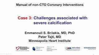 Case 3 PCI Manual  Challenges associated with severe calcification [upl. by Zoubek]