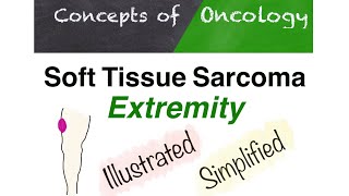 Extremity soft tissue sarcoma [upl. by Ajnotal]