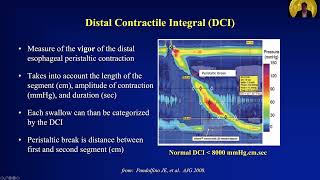 Manometry Report Interpretation Essentials Dos and Donts [upl. by Mian]