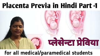 What is Placenta Previa causestypessigns amp symptoms part1  प्लेसेंटा प्रेविया कारणलक्षणप्रकार [upl. by Blakelee]