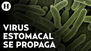 Extraño virus estomacal se propaga en EU estos son los síntomas de la shigelosis [upl. by Annoyi]