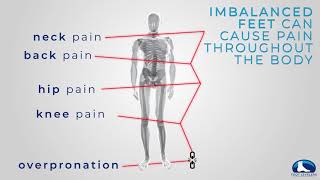 Overpronation and the footspine connection [upl. by Adeys]