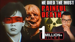 वो अपने मरे शरीर में 83 Days तक तड़पता रहा The Most Painful and Scary Story of Hisashi Ouchi [upl. by Nymrak]