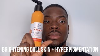 HOW I GOT RID OF DARK SPOTS BRIGHTEN DULL SKIN  HYPERPIGMENTATION [upl. by Ranitta]