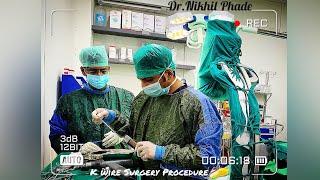 K Wire Surgery Procedure  Operation in 5th Metacarpal Hand wrist  Boxer Fracture  How to perform [upl. by Lehctim547]