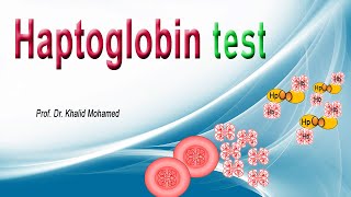 Haptoglobin Test تحليل هابتوجلوبين [upl. by Ahsemaj]