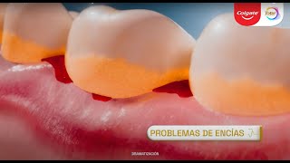 Previene problemas de encías con Colgate Total [upl. by Rehpetsirhc352]