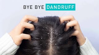 Home remedies to get rid of DANDRUFF permanently 10 NATURAL dandruff remedies that work [upl. by Enedan]