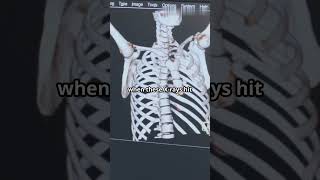 How XRays Works Explained under 60 Seconds [upl. by Medlin]