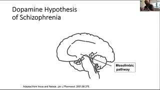 Tardive Dyskinesia Recognition and Treatment [upl. by Irakab]