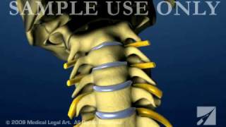 Cervical Spine and Intervertebral Disc Anatomy  Female Version [upl. by Ycnay53]