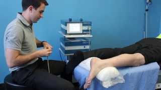 Shockwave Therapy Toronto Plantar Fasciitis Treatment [upl. by Eniahpets]