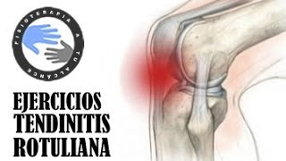 Tendinitis rotuliana ejercicios tratamiento y rehabilitacion [upl. by Notsew]