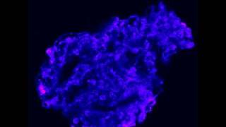 Calcium efflux fluo3 from a glomerulus Ionomycin [upl. by Tija]