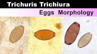 Trichuris Trichiura eggs Morphology  Clear Explain [upl. by Ajak107]