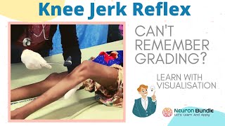 knee jerk reflex I all 4 grades with demo on patients I brisk tendon reflex rootvalue I neurology [upl. by Pearline]